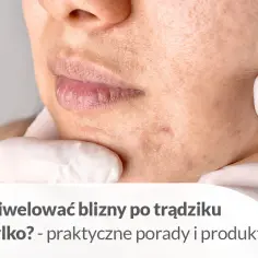 Skuteczne metody na gojenie ran po pryszczach i bliznach skórnych